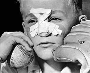 <b class=qtipBold><figcaption>Fly Ball Gives Broken Nose</figcaption></b><br>Topeka, Kansas: June 7, 1962 A nine year old boy with a broken nose from when he misjudged a fly ball in practice with his father.<br><em>© Underwood Archives/UIG</em> Fly Ball Gives Broken Nose