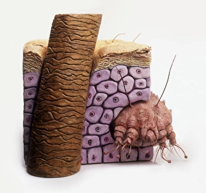 Model of Itch mite (Sarcoptes scabiei) burrowing inside human skin Model of Itch mite (Sarcoptes scabiei) burrowing inside human skin