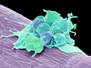 Anatomical Gallery: Activated platelets, SEM
