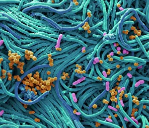 Bacteria found on mobile phone, SEM Bacteria found on mobile phone, SEM