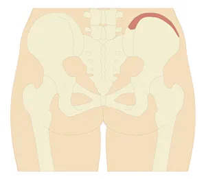 Cross section biomedical illustration of iliac crest site on pelvis Cross section biomedical illustration of iliac crest site on pelvis