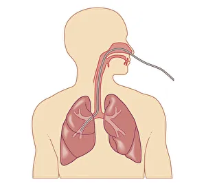 Cross section biomedical illustration of route of bronchoscope inserted through nose Cross section biomedical illustration of route of bronchoscope inserted through nose