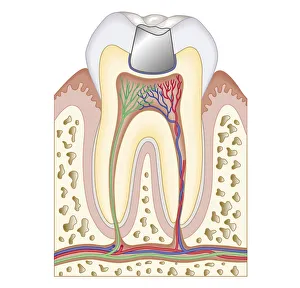 Cross section biomedical illustrationBiomedical illustration of dental filling Cross section biomedical illustrationBiomedical illustration of dental filling