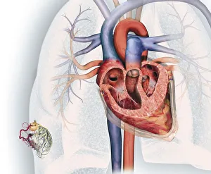 Cross section of human heart and, bottom left, coronary system with aorta, coronary arteries Cross section of human heart and, bottom left, coronary system with aorta, coronary arteries