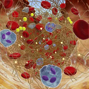 Cross section showing wound below skin, long fibrin threads trapping red blood, yellow platelets cau Cross section showing wound below skin, long fibrin threads trapping red blood, yellow platelets cau