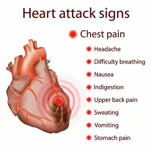 Anatomical Gallery: Heart attack signs, illustration