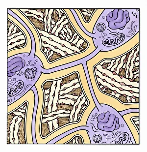 Illustration showing Osteoporosis in human bone Illustration showing Osteoporosis in human bone