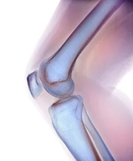 Normal knee, X-ray