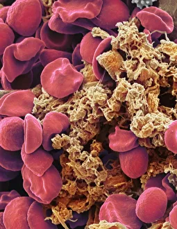 Red blood cells and platelets, SEM Red blood cells and platelets, SEM