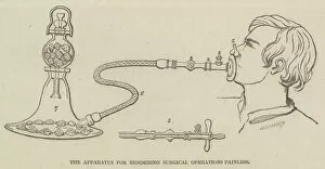 The Apparatus for rendering Surgical Operations Painless (engraving)