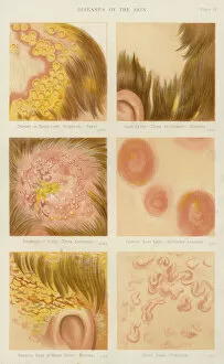 Diseases of the skin (colour litho)