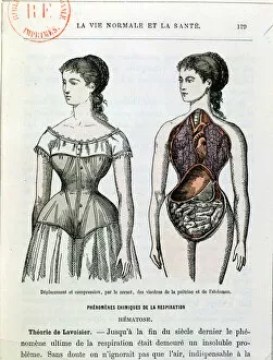 Cut Away Gallery: The Harmful Effects of the Corset, illustration from La Vie Normale et la Sante'
