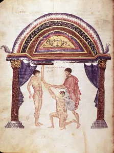 Medicine: reduction of a dislocated elbow, patient is hanged by the arm (manuscript Medicine: reduction of a dislocated elbow, patient is hanged by the arm (manuscript