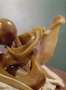 Model showing the articulation of the knee (wax) Model showing the articulation of the knee (wax)
