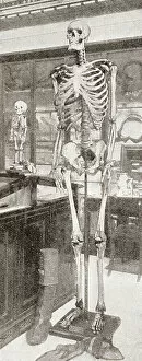 Dwarf Gallery: The skeletons of Charles Byrne, 1761-1783, 'The Irish Giant' right