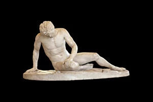 Injuries Gallery: Statue of the Capitoline Gaul (marble)