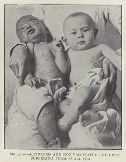 Vaccinated and Non-Vaccinated Children Suffering from Small-Pox (b/w photo)
