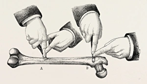 the method of using the rugine, medical equipment, surgical instrument, history of the method of using the rugine, medical equipment, surgical instrument, history of