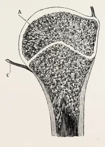 upper end of the humerus, medical equipment, surgical instrument, history of medicine upper end of the humerus, medical equipment, surgical instrument, history of medicine
