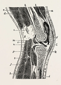 vertical section of knee-joint, medical equipment, surgical instrument, history of vertical section of knee-joint, medical equipment, surgical instrument, history of