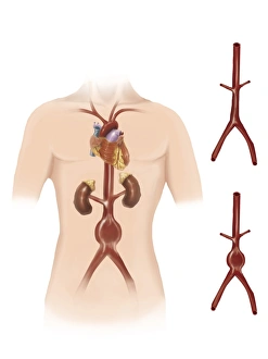 <b class=qtipBold><figcaption>Medical</figcaption></b><br><br><em>© Alan Gesek/Stocktrek Images</em> Medical