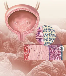 Female Reproductive System Anatomy Prints: Detail of the cellular structure that forms the bladder lining
