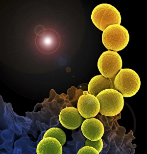 A colorized scanning electron micrograph of a white blood cell eating MRSA A colorized scanning electron micrograph of a white blood cell eating MRSA