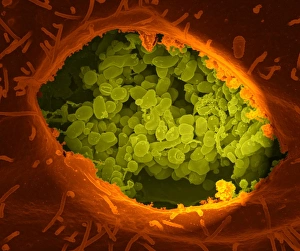 Coxiella burnetii, the bacteria that causes Q Fever Coxiella burnetii, the bacteria that causes Q Fever