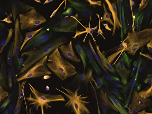 Differentiation Gallery: Directed differentiation of multipotential human neural progenitor cells