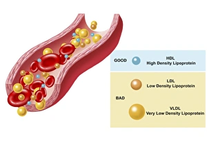 Good and bad cholesterol found in blood stream Good and bad cholesterol found in blood stream