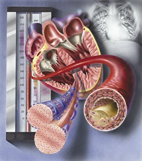 Interior view of heart with detail of muscle cells and atherosclerotic artery Interior view of heart with detail of muscle cells and atherosclerotic artery
