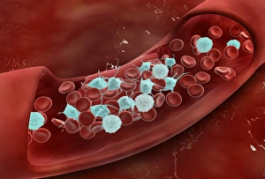 Microscopic view of blood clotting inside the artery Microscopic view of blood clotting inside the artery