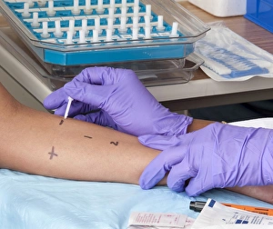 A person receiving a skin prick allergy test A person receiving a skin prick allergy test