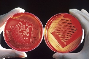 Red blood cells on an agar plate are used to diagnose infection Red blood cells on an agar plate are used to diagnose infection