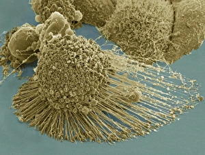Scanning electron micrograph of an apoptotic HeLa cell Scanning electron micrograph of an apoptotic HeLa cell