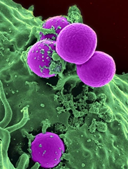 Scanning electron micrograph of a human neutrophil ingesting MRSA Scanning electron micrograph of a human neutrophil ingesting MRSA