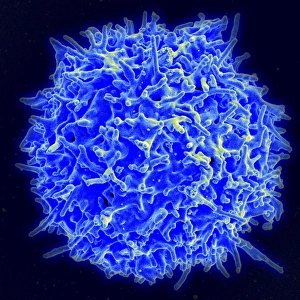 Scanning electron micrograph of a human T cell Scanning electron micrograph of a human T cell