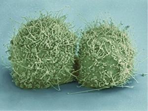 Scanning electron micrograph of just-divided HeLa cells Scanning electron micrograph of just-divided HeLa cells