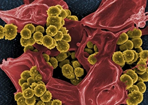 Scanning electron micrograph of Staphylococcus and a dead human neutrophil Scanning electron micrograph of Staphylococcus and a dead human neutrophil