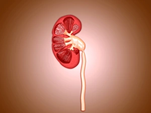 Ureteropelvic junction (UPJ) obstruction in the kidney Ureteropelvic junction (UPJ) obstruction in the kidney