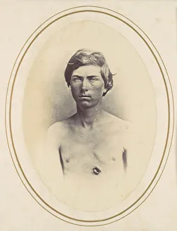 Albumen Silver Print Art Prints: Frederick A. Bentley, 1865. Creator: Reed Brockway Bontecou