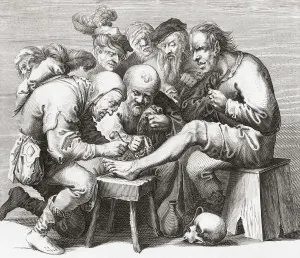 In the 17th century, a surgeon performs surgery on a man's foot. After a 17th century work In the 17th century, a surgeon performs surgery on a man's foot. After a 17th century work