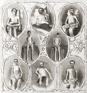 The deplorable physical state of eight Union soldiers after being released from a Confederate prison towards the end of The deplorable physical state of eight Union soldiers after being released from a Confederate prison towards the end of