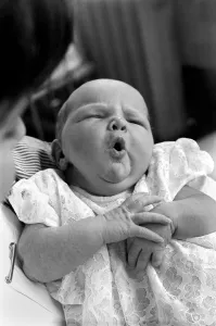 Baby girl yawns in the children's hospital in Myrtle street, Liverpool Baby girl yawns in the children's hospital in Myrtle street, Liverpool