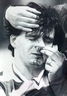 Charlie Nicholas Celtic player injured 1982 celtic player charlie nicholas with a Charlie Nicholas Celtic player injured 1982 celtic player charlie nicholas with a