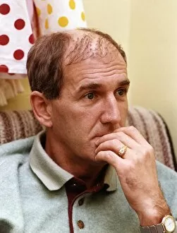 Images Dated 12th September 1990: Russ Abbot in a theatre dressing room shows his Hair Transplant A©Mirrorpix
