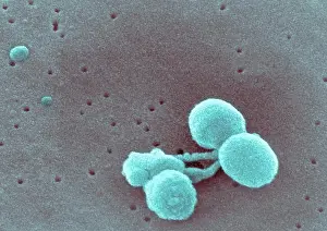 Scanning Electron Micrograph Print of Streptococcus pneumoniae Bacteria