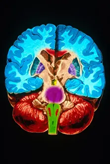 Human Brain Anatomy Prints: Brain, Coronal Section
